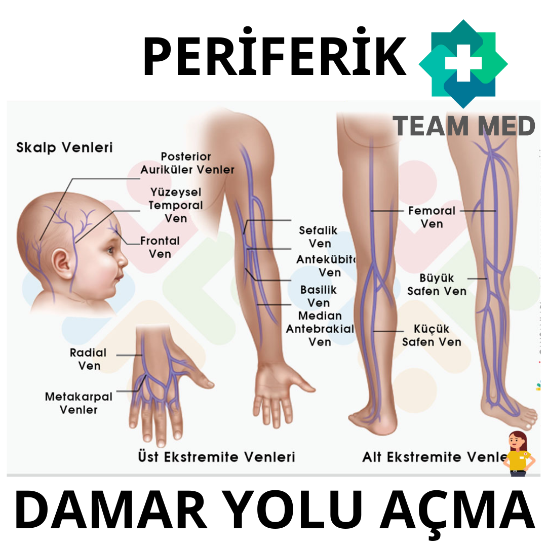 Periferik damar yolunun açılması